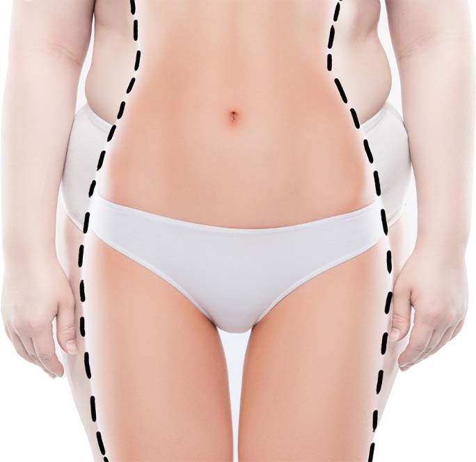 Fat Reduction
