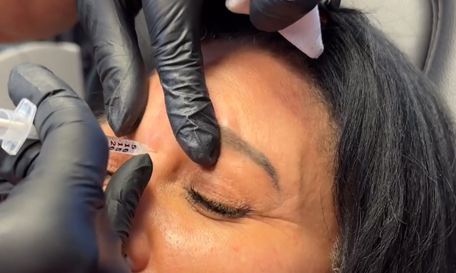 Facial Balancing with Injectables 1