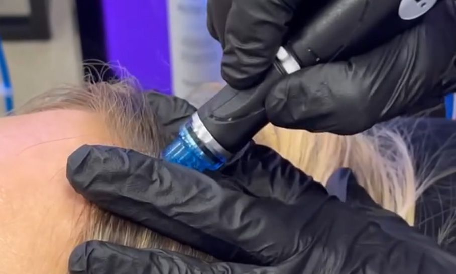 Face/Scalp & Hair Restoration 2