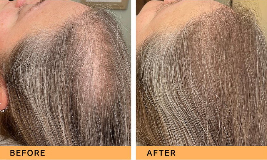 Face/Scalp & Hair Restoration 3