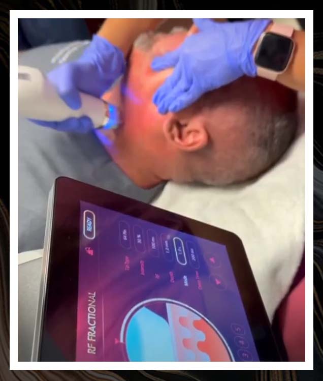 Hydrofacial 1