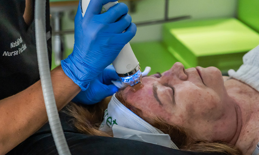 Discoloration and Hyperpigmentation 4