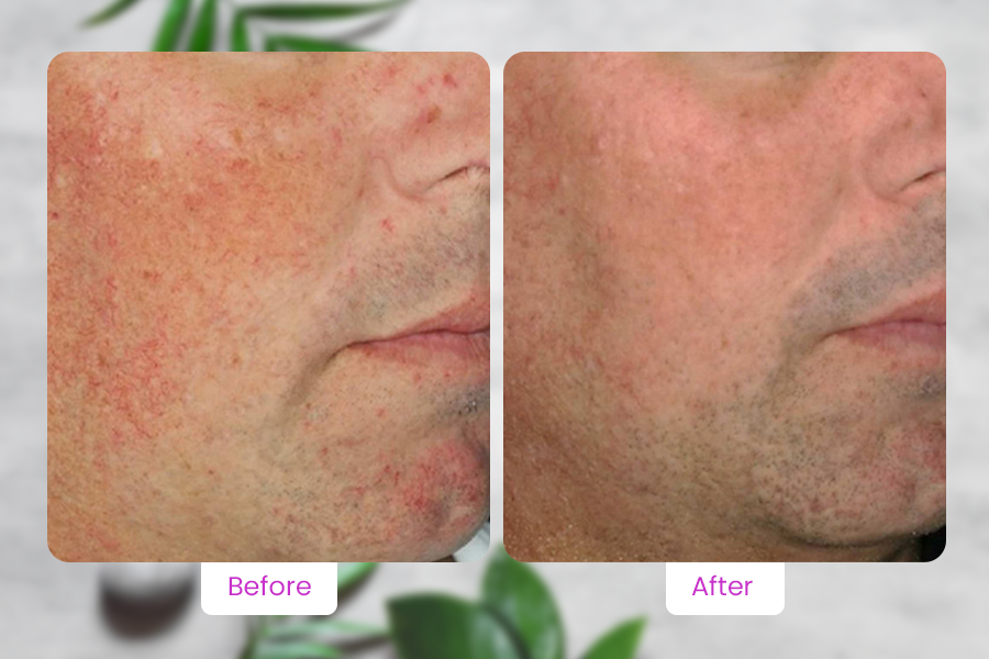 Consistent Spa Treatments for Youthful Skin - Featured Image