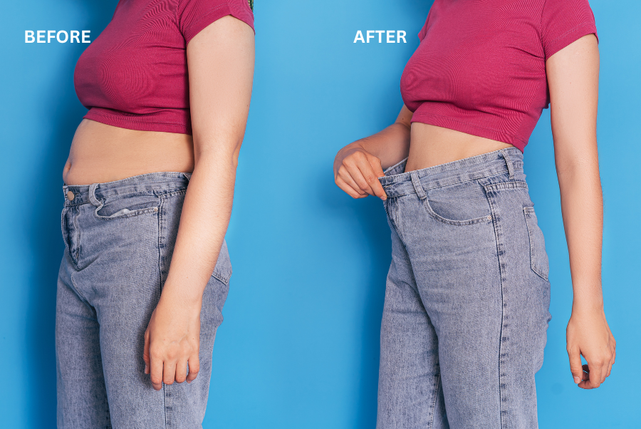 trusculpt iD - Featured Image