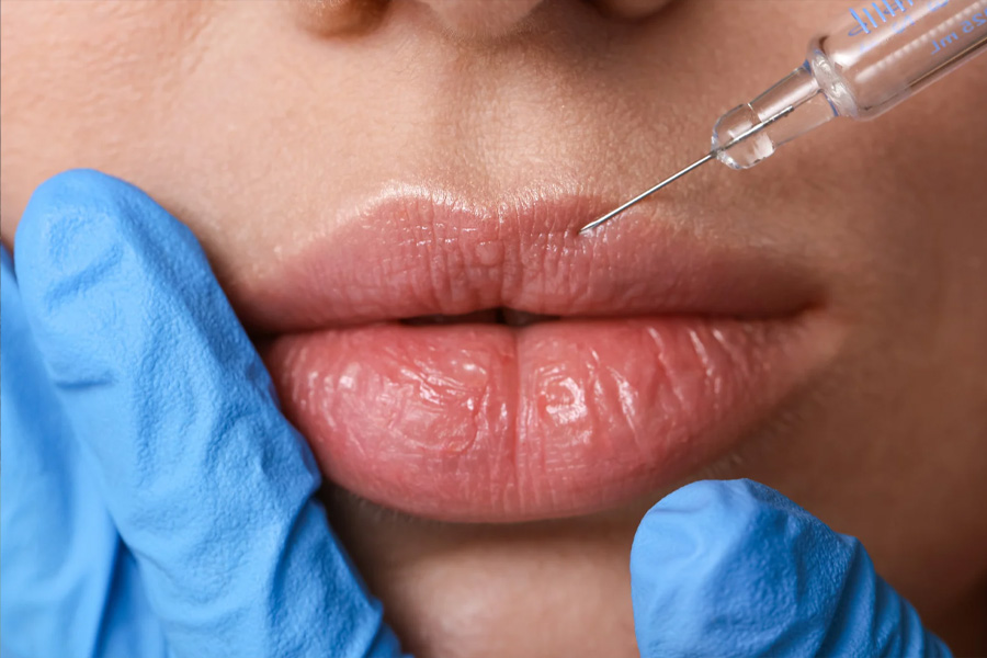 Dermal Filler Treatments - Understand the Areas That Can Be Treated