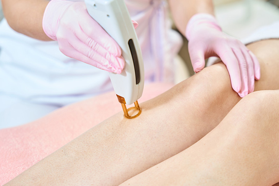 Med Spa in Hilton Head Island - Laser Hair Removal