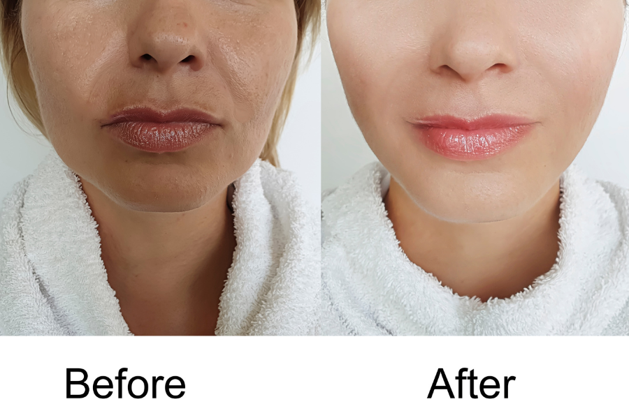 Med Spa Services - Laser