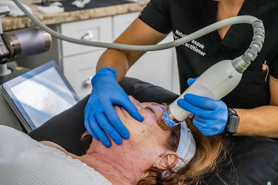 Microneedling Hilton Head