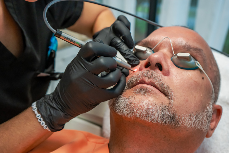 Excel V+ Photorejuvenation treatment in Hilton Head medical spa
