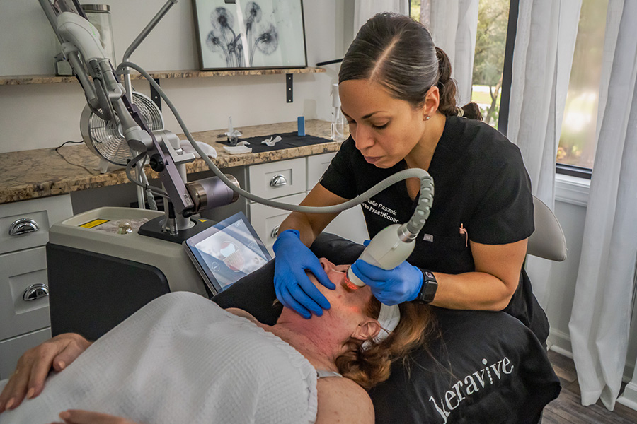 RF microneedling session for fine line treatment Hilton Head