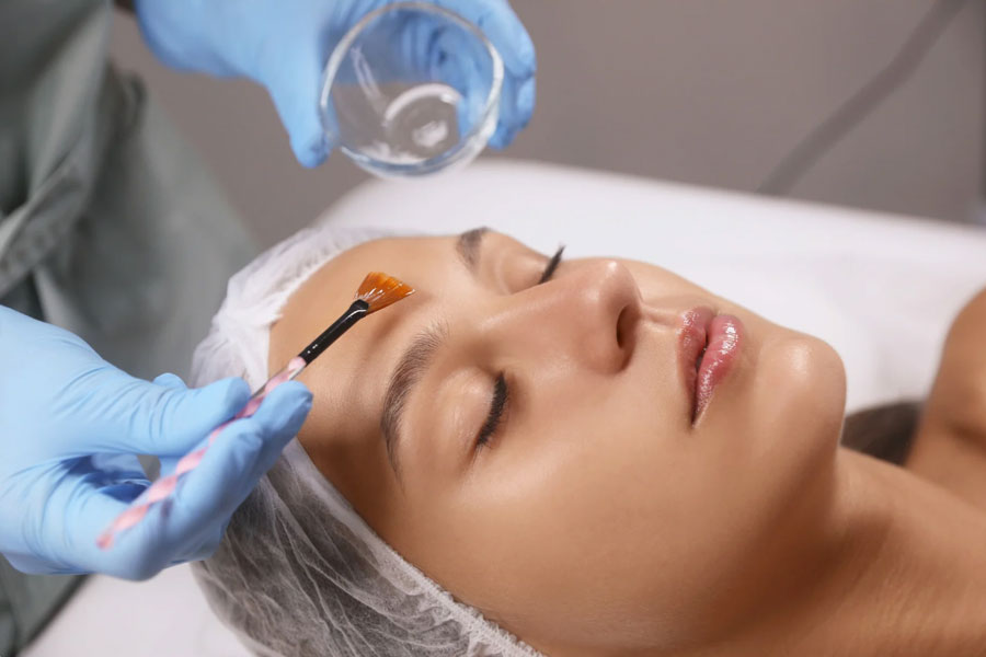 Chemical peel for age spot removal Hilton Head improving skin tone