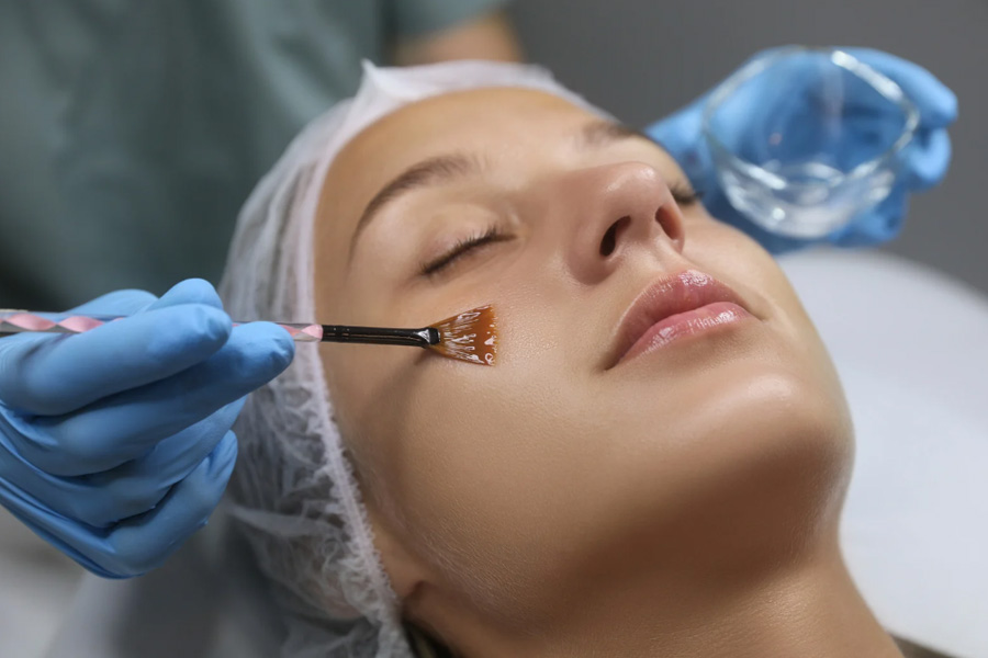 Chemical peel treatment for rosacea Hilton Head