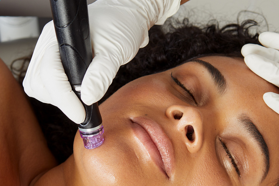 Hydrafacial treatment for rosacea at Hilton Head medical spa