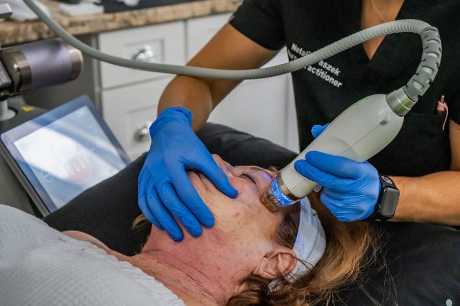 RF microneedling skin laxity treatment in Hilton Head SC
