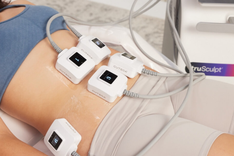 TruSculpt iD fat reduction treatment at OneCareSpa Hilton Head