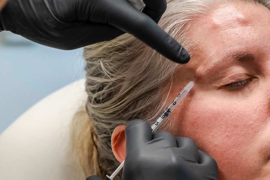 Licensed aesthetic provider administering Botox injections to a patient's forehead and crow's feet area during a facial wrinkle treatment.
