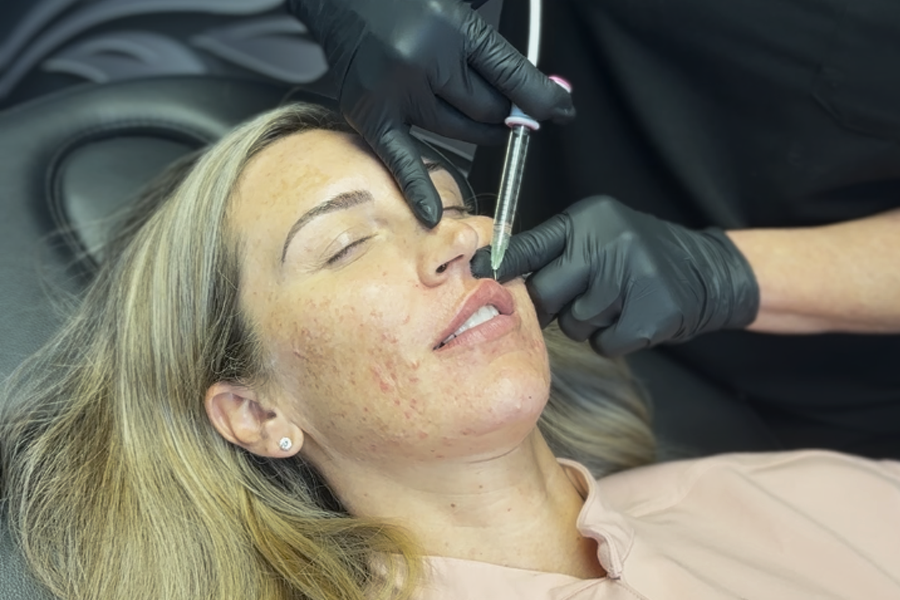 Juvederm and Restylane filler treatments Hilton Head Island for lips and cheeks