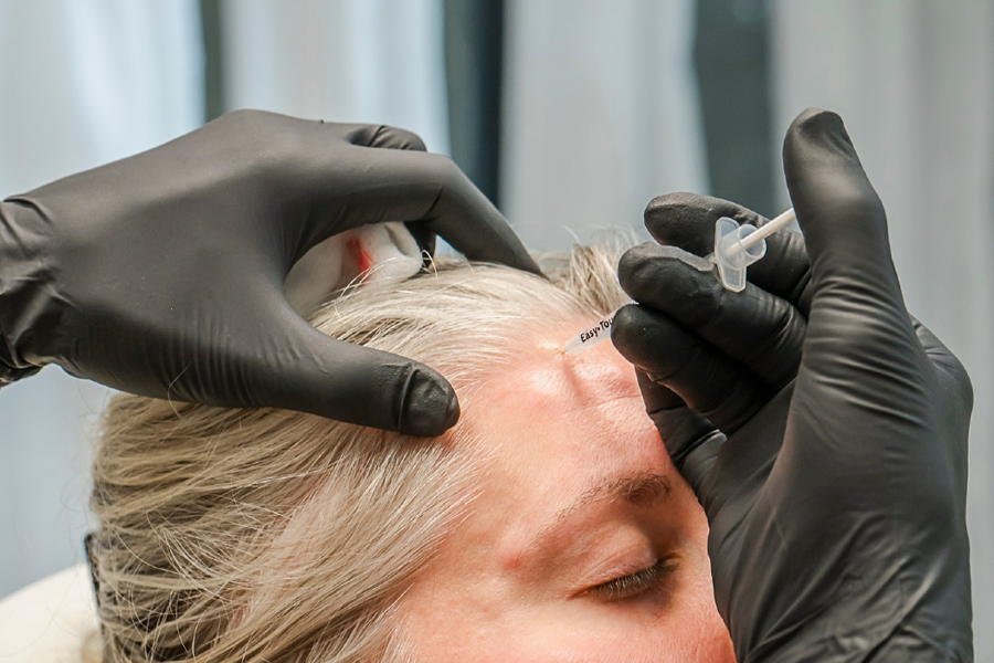 Dysport injectables Hilton Head SC treatment for natural wrinkle reduction