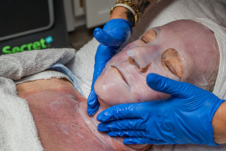 Hydration facial restoring moisture for Hilton Head SC sun-exposed skin