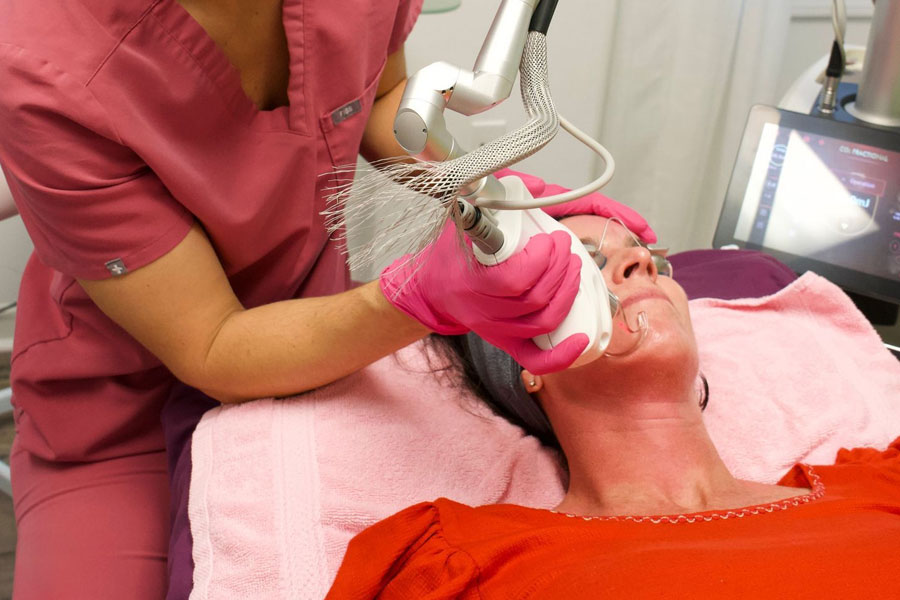 Acne scar laser treatment in Hilton Head Island at a medical spa