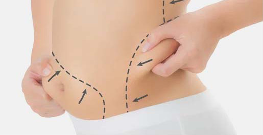 body-fat reduction