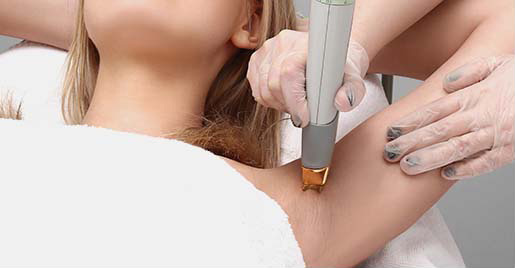 body-laser hair removal