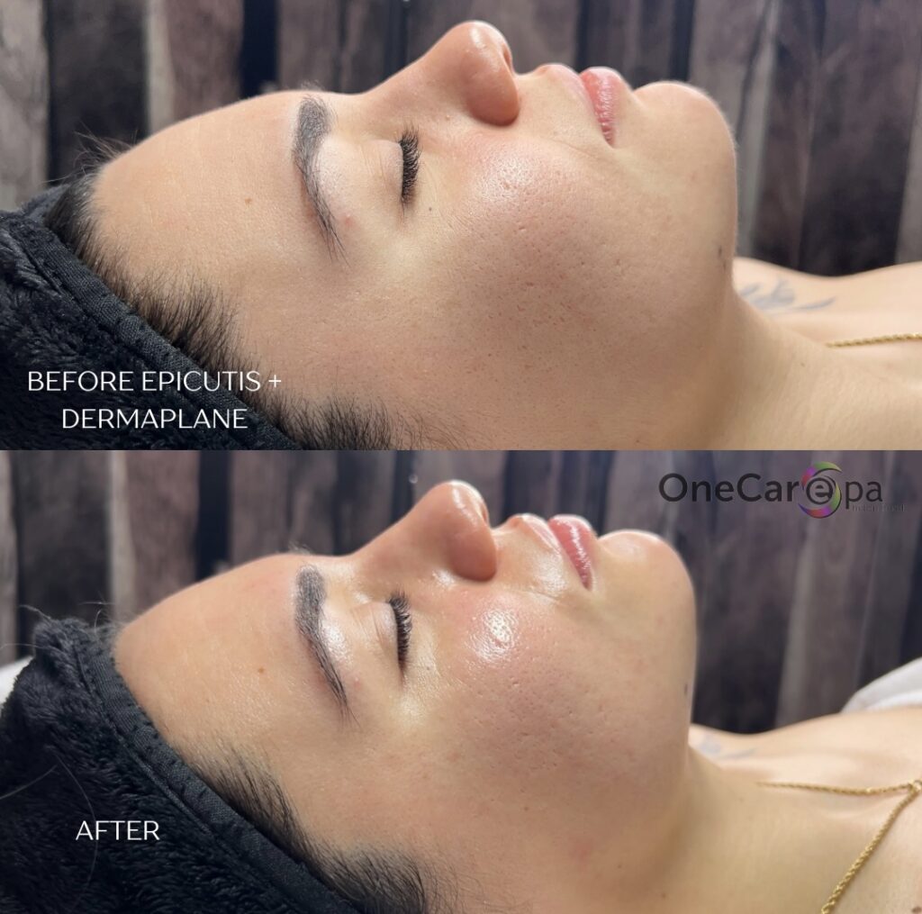 facials-1