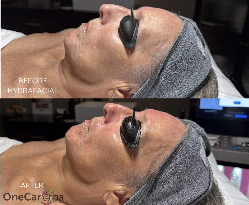 facials-2